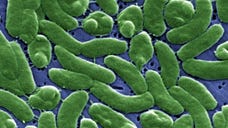 Vibrio vulnificus is an infection caused by a bacteria found in warm salt water. It's in the same family of bacterium that causes cholera. So far this year,  people across Florida have been infected by the severe strain of vibrio, and  have died.